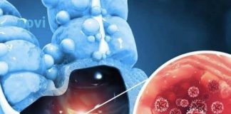 0V0 SU MALl SlGNALl 0PAKE B0LESTl: 4 jasna znaka raka debelog crijeva koje tijelo šalje mjesecima prije